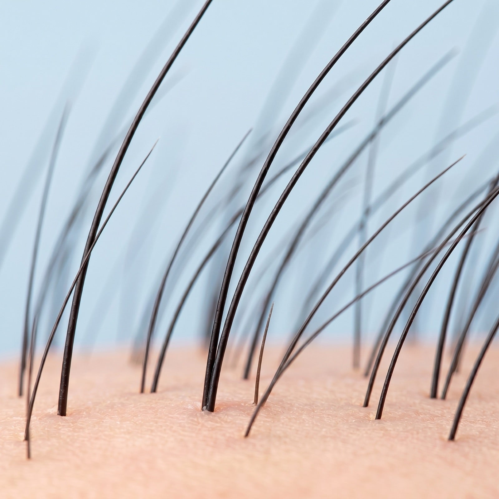 Why your roots can wake back up.